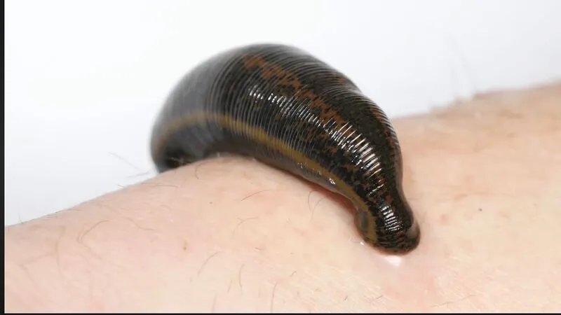 Giấc mơ về đỉa luôn chứa đựng nhiều ý nghĩa khác nhau